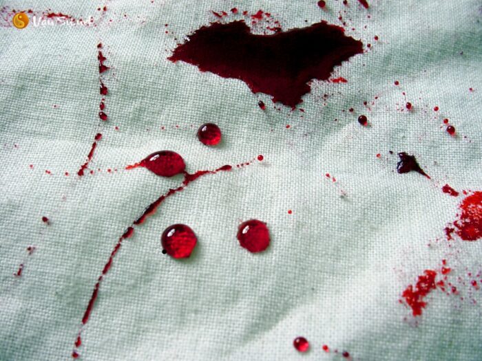 Mơ thấy vùng kín chảy máu đánh 44, 56, 43, 65, 77, 65