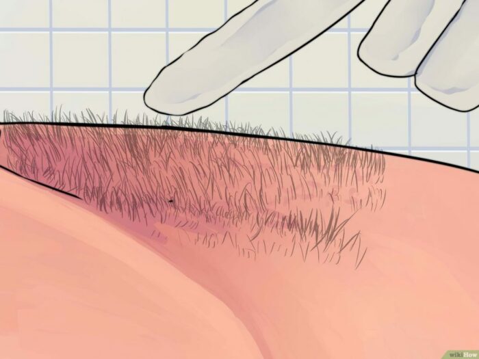 Thấy Cạo lông vùng kín thì 45, 66, 34, 67, 32, 77